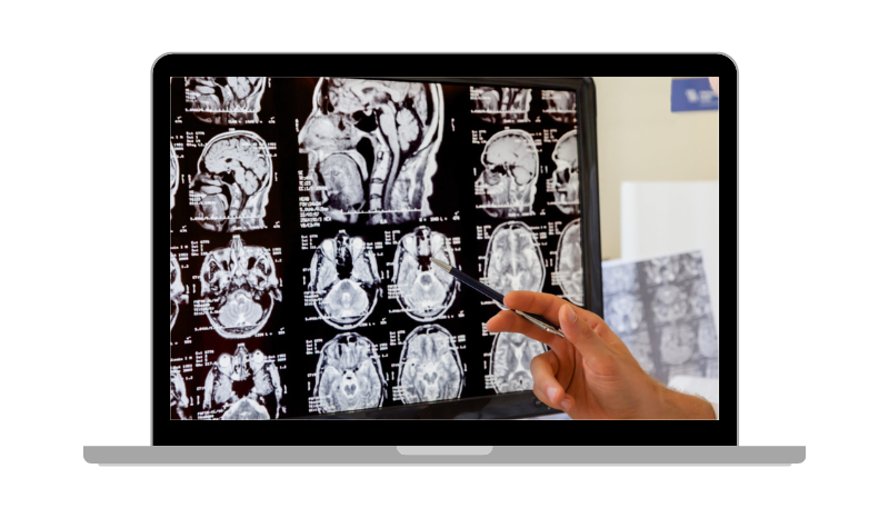 Image of Laptop with MRI