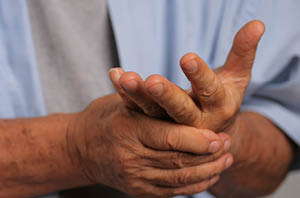 Neurologist performing basic neurological exam